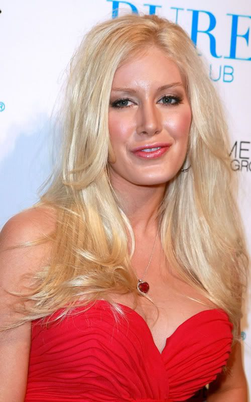heidi montag after surgery photos. After waiting for the swelling